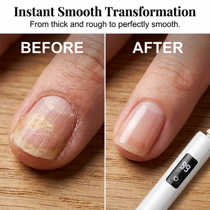 💅 LIMITED-TIME 50% OFF! ✨ Professional Electric Nail Polisher – Digital Speed Display, Multiple Attachments, Ergonomic Grip 💎